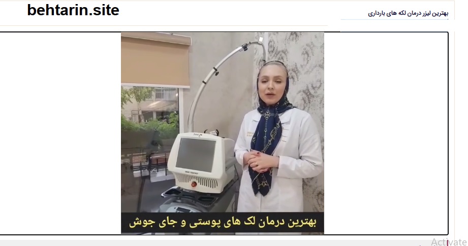 لکه های بارداری
