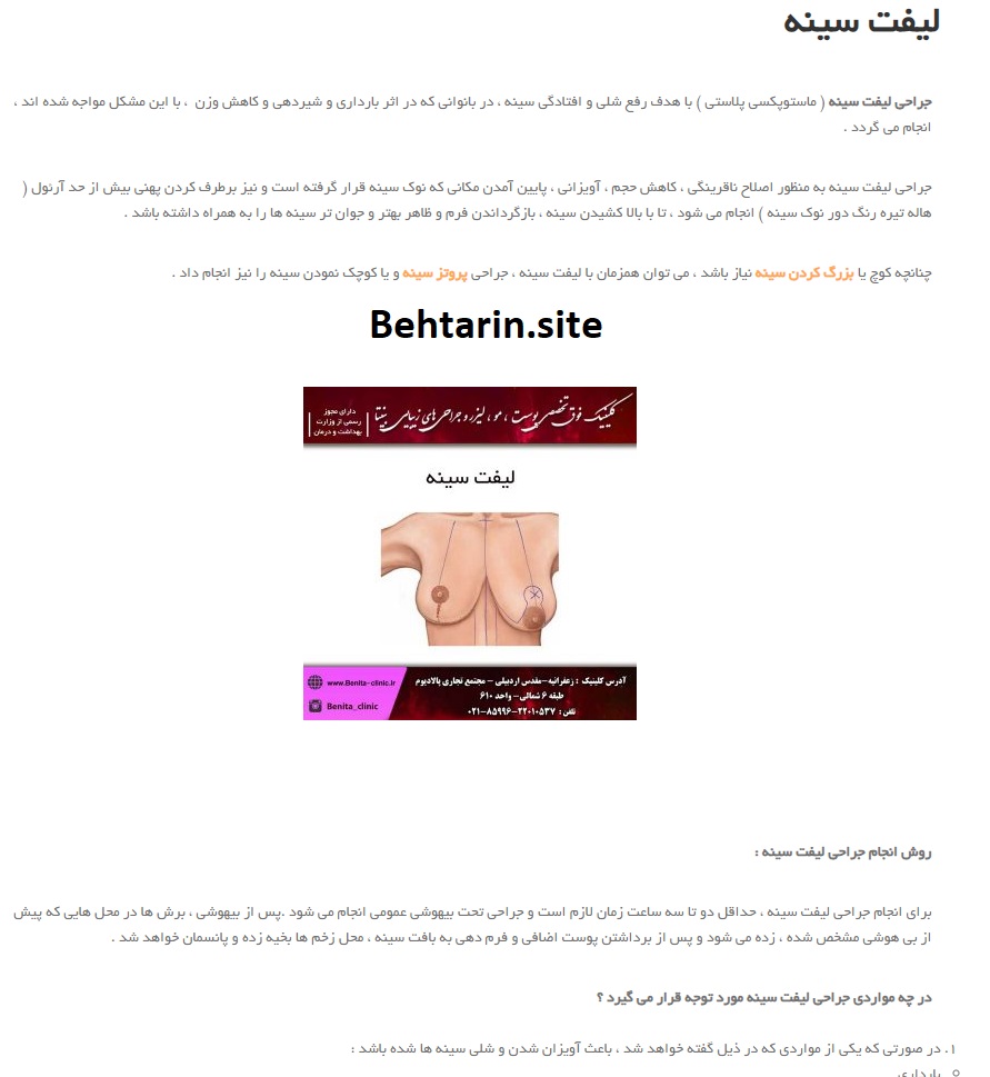 بینتا-لیفت سینه