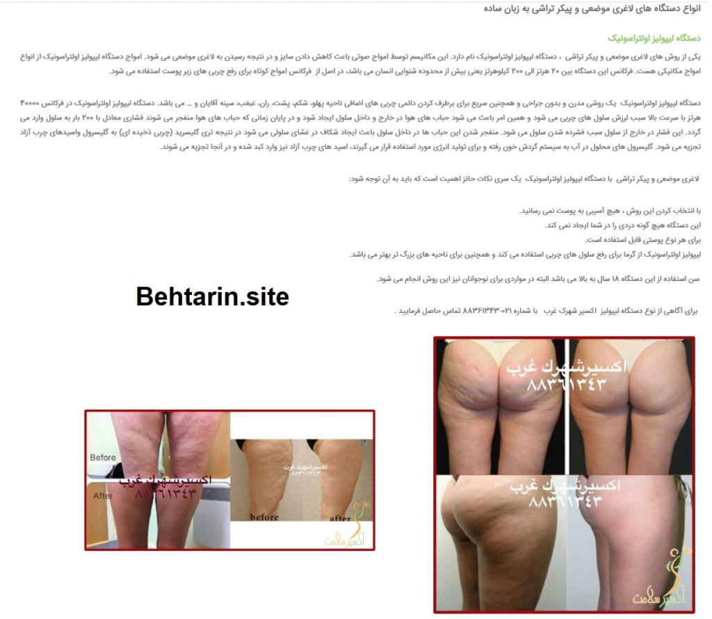اکسیر-لاغری باسن