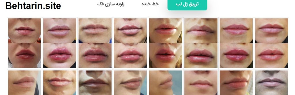 آتریسا-گالری تصاویر