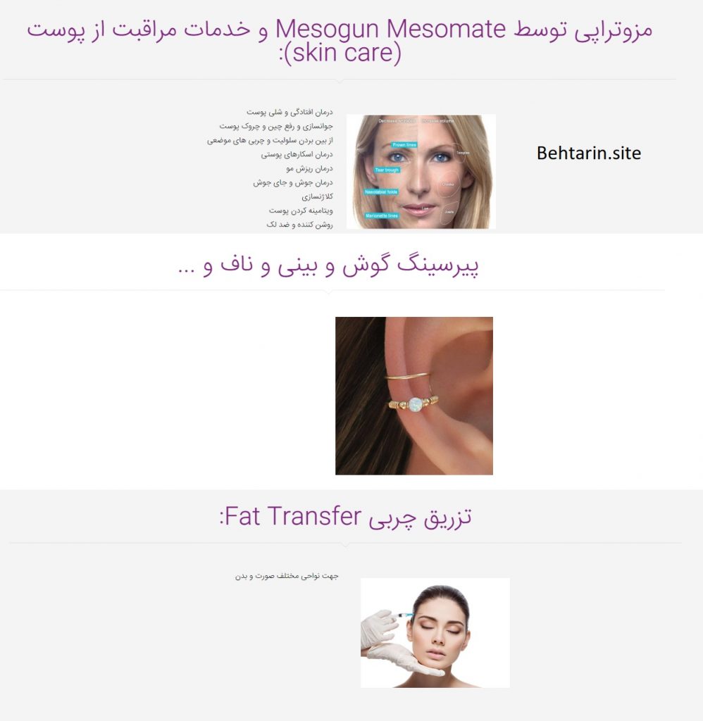 روما-زیبایی