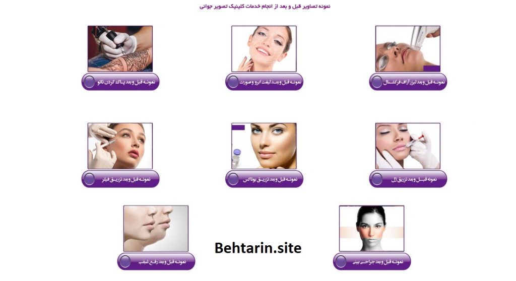 تصویر جوانی-دسته بندی ها